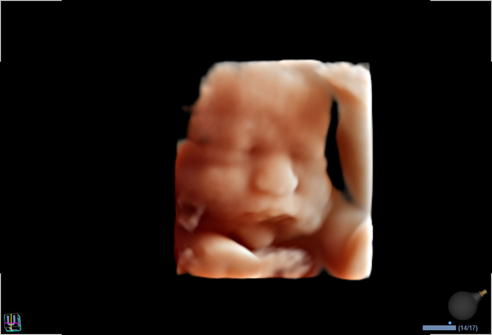 25-35wk-fetal-face-with-Live-HQ™