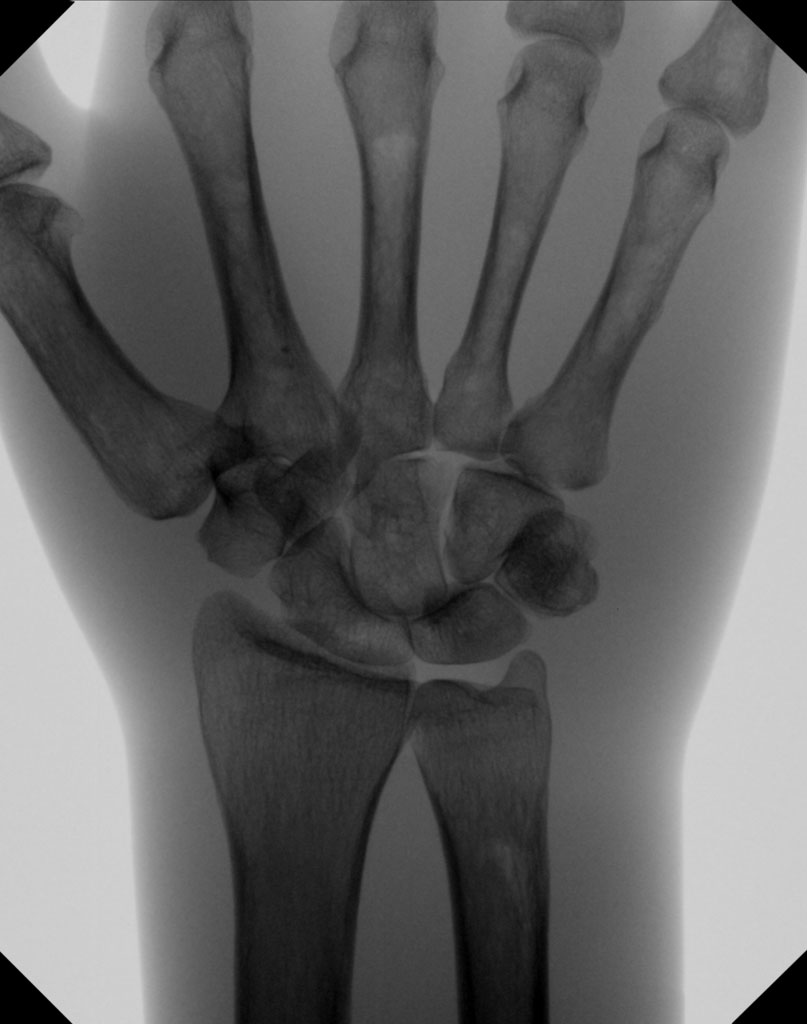 mobile-di-clinical-image-hand-ap__web