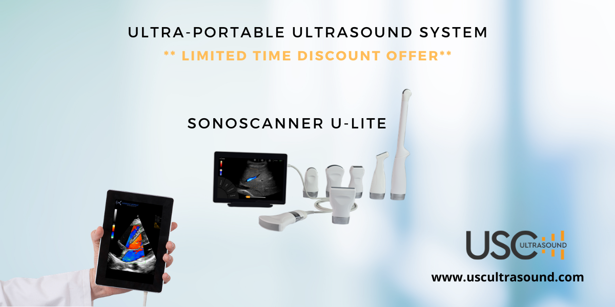Portable Handheld Ultrasound – Sonoscanner U-Lite Special!