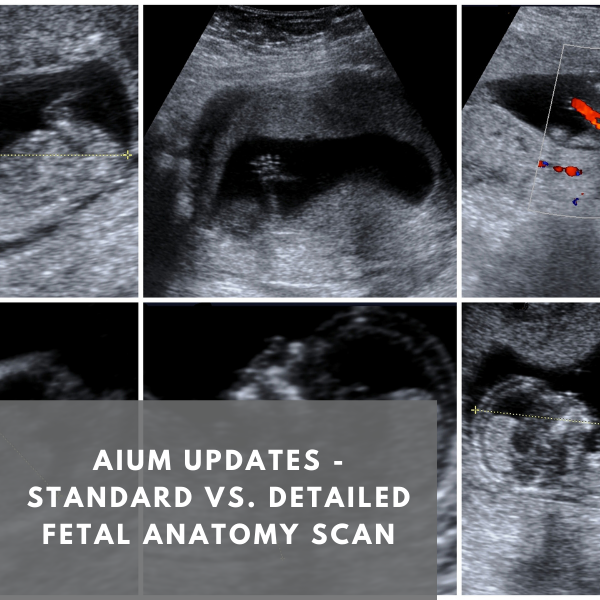 fetal anatomy scan