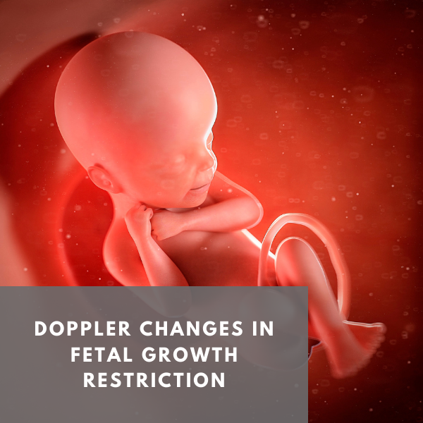 Fetal Growth Restriction