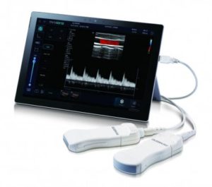 Alpinion Minisono Ultrasound