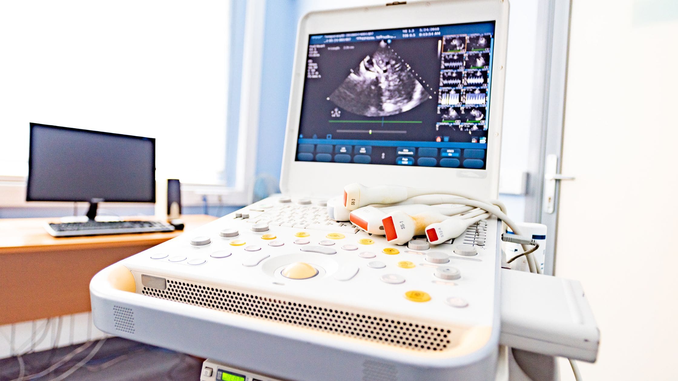 What Are The Different Types of Ultrasound Machines and Their Uses and Applications?