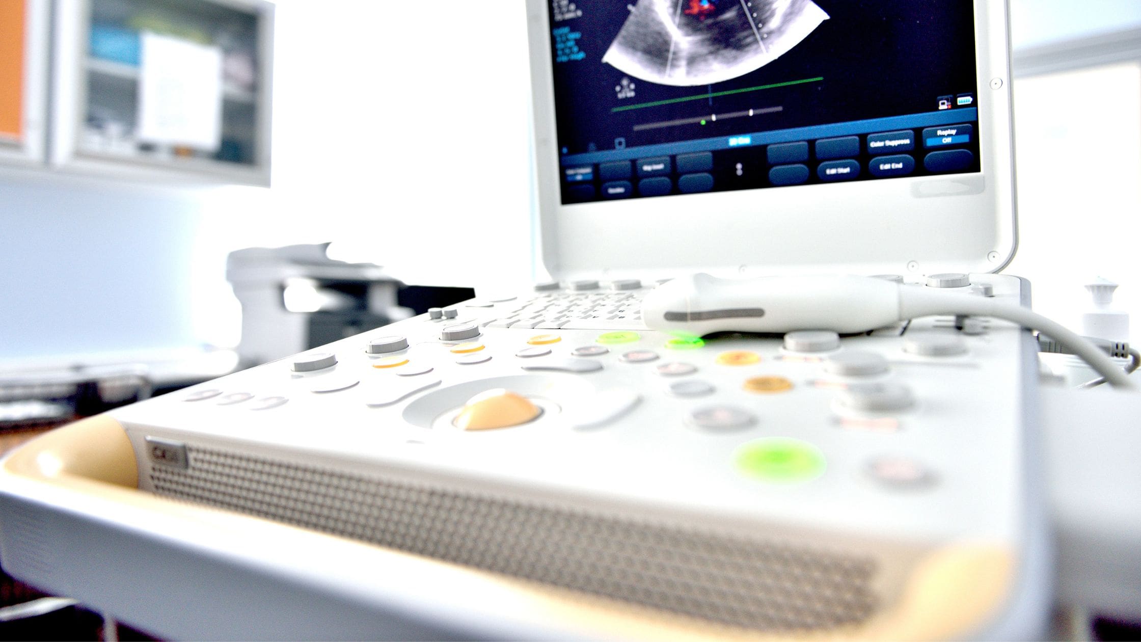 Ultrasound Buyer’s Guide – How to Choose an Ultrasound System or Machine