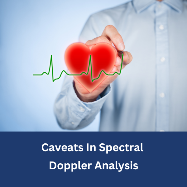 Spectral Doppler Analysis