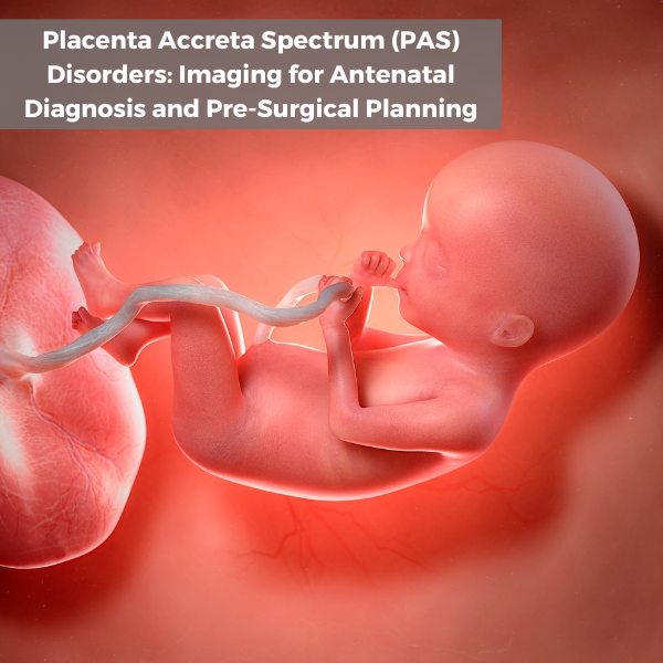 Placenta Accreta Spectrum Disorders